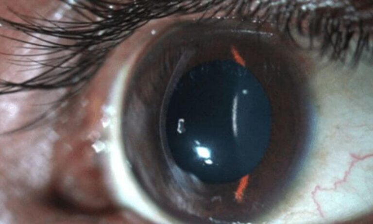 blog-95-1-1-1200x720