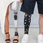 Modern Prosthetic