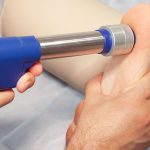 Shockwave Therapy