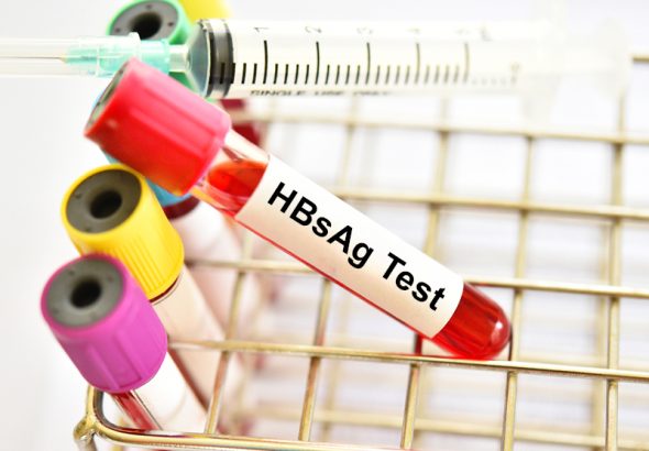 HBsAg Test
